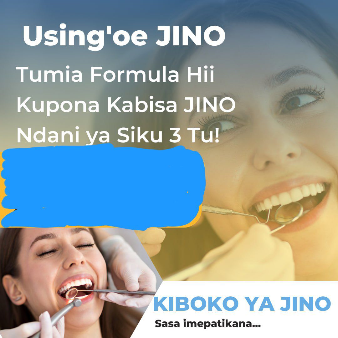 Kiboko Ya Jino